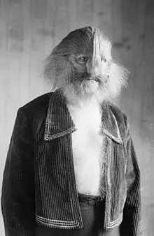 220px-StephanLIonFacedMan