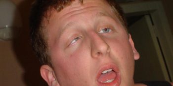 Vücudunuz Hakkında Bilmediğiniz 15 Gerçek