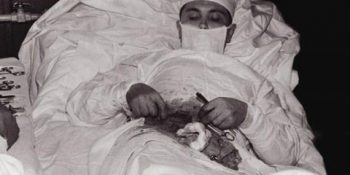 Kendi Apandisit Ameliyatını Kendi Yapan Sovyet Doktor: Leonid Rogozov