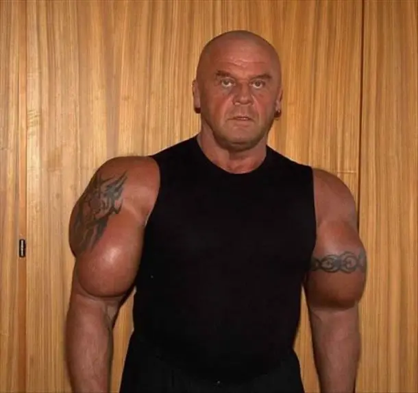 2-body-builging-fail-streoid-synthol