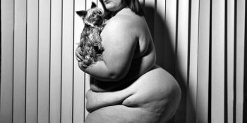 Toplumun Estetik Yargılarına Kafa Tutan 19 Kilolu Kadın Fotoğrafı