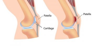 İtibar Manyakları İçin Biçilmiş Kaftan 14 Karizmatik Hastalık İsmi