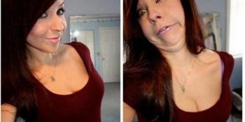 Ansızın Çok Çirkinleşebilen 21 Çok Güzel Kız