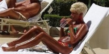 Bronz Ten Sevdası Yüzünden Kendini Yakan 12 İnsan