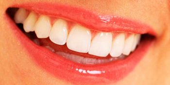 13 Maddeyle Yağ Çekme Nedir? Ağız ve Diş Sağlığına Faydası Var mıdır?