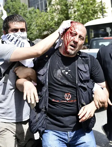 ahmet-sik-gezide-yaralanmisken