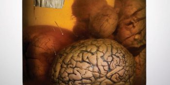 Siz Siz Olun Beyninizi Kavanozda Unutmayın Dedirten 8 Fotoğraf