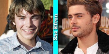 Büyüdüğü Zaman Ne Denli Seksi Olabileceğini Hayal Edemediğimiz 13 Ünlü