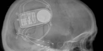 Yakın Dönemde Kullanıma Girecek Hayat Kurtaran 5 Teknolojik Buluş