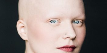 8 Muhteşem Fotoğrafla ‘Her Kadın Uzun Saçlı Olmak Zorunda Değildir’