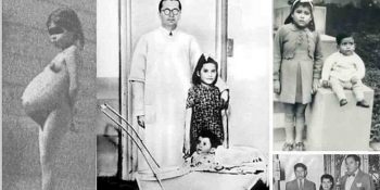 6 Çok Acayip İnsan ve Kayıtlara Geçmiş Dünyanın En Tuhaf Ölüm Vakaları