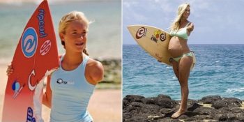 Köpek Balığı Saldırısı Sonucu Kolunu Kaybeden Bethany’nin Umut Verici Hikayesi