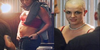 Saç Dökülmesine Sebep Olduğunu  Zannettiğiniz 13 Yanlış Bilgi