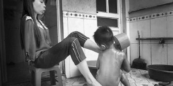 Savaşın Korkunç İzlerini Taşıyan Bir Genç Kızın Fotoğraflarla Yaşamı