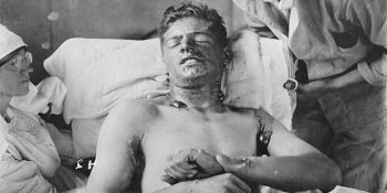 ABD Hükümetinin İnsanlar Üzerinde Yaptığı 10 Korkunç Deney