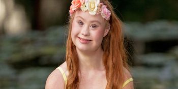 Güzellik Algısını Sorgulatan Down Sendromlu Manken Madeline’nin İlham Veren Hikayesi