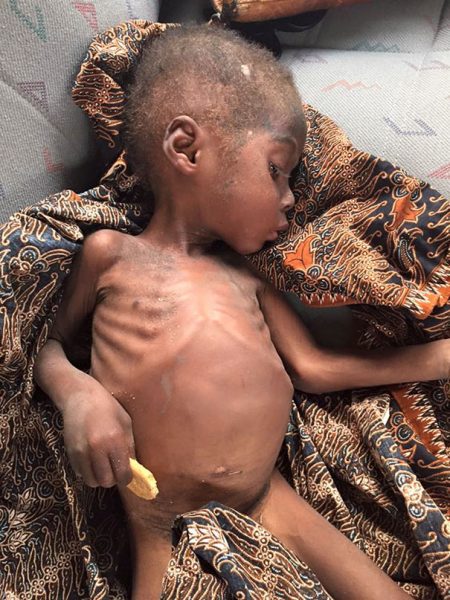 nigerian-witch-boy-starving-thirsty-recovery-anja-ringgren-loven-251