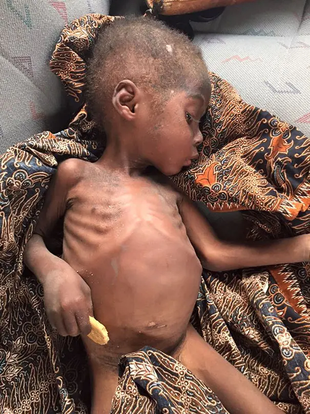 nigerian-witch-boy-starving-thirsty-recovery-anja-ringgren-loven-251