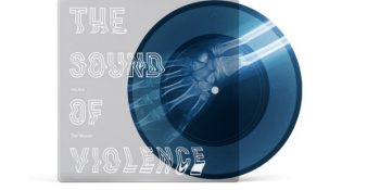 Kadına Şiddete Karşı Tek Ses: Farkındalık İçin Hazırlanmış “Röntgen Plaklar”