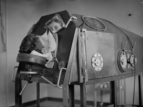 1938: A patient lying in an artificicial respiration machine called an iron lung. (Photo by London Express/Getty Images)