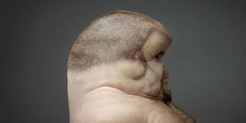 Trafik Kazalarına Karşı Son Derece Dayanıklı Bir İnsan Graham İle Tanışın