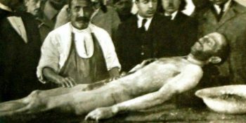 Sahipsiz Biri Gibi Ölen ve Cesedi Kadavra Yapılan Ünlü Yazarımız Ömer Seyfettin’in Hazin Hikayesi