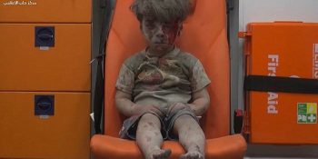 Suriye’deki Korkunç Savaşın Tek Fotoğrafla Özeti: Ambulansta Bekleyen Yaralı Çocuk