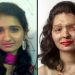 Uğradığı Asit Saldırısı Sonucu Hayatı Değişen Reshma Qureshi’nin İlham Veren Hikayesi