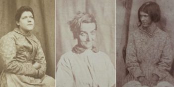 Hastalarının Fotoğraflarını Çekerek Teşhis Koyan Viktoryan Dönemi Psikiyatristi Hugh Welch Diamond