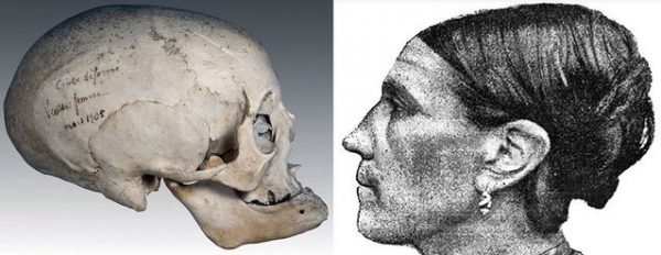 Cranial Deform Toulouse Combo