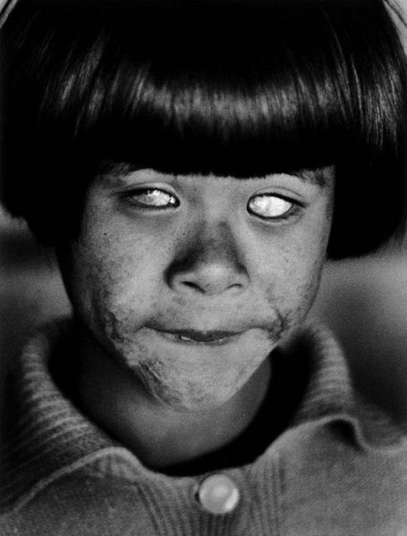 a-child-blinded-by-the-hiroshima-atomic-bomb-in-1945-photo-u1