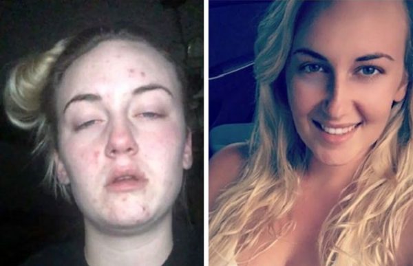 before-after-drug-addiction-54-585d1b2a0fb13__605