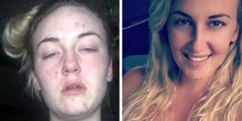 Uyuşturucudan Kurtulduktan Sonra Bambaşka Hayatlara Sahip Olan 14 İlham Verici İnsan