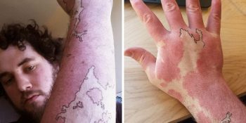 Doğum Lekelerini Zekice Kamufle Eden 18 Yaratıcı Dövme Örneği