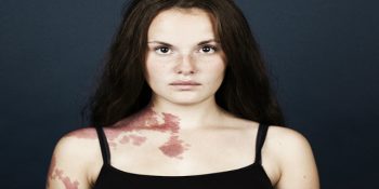 Kusursuz Görünme Arzusuna Tokat Niteliğindeki Fotoğraf Projesi