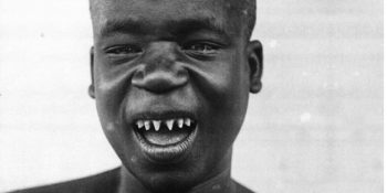 Tarihin En Büyük Utançlarından Olan İnsanat Bahçelerinin Sembol İsmi; Ota Benga