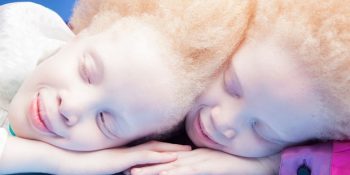 Modaya Damgasını Vuran Albino İkizlerin Şok Etkisi Yaratan Güzellikteki 11 Fotoğrafı