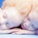 Modaya Damgasını Vuran Albino İkizlerin Şok Etkisi Yaratan Güzellikteki 11 Fotoğrafı