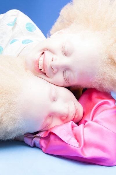 albino-twins-models-5-58e74b02ae042__880