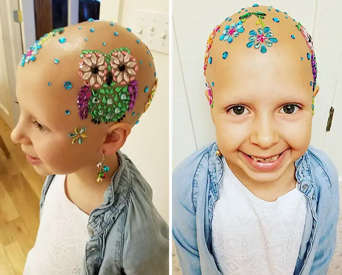 girl-alopecia-crazy-hair-day-gianessa-wride-12