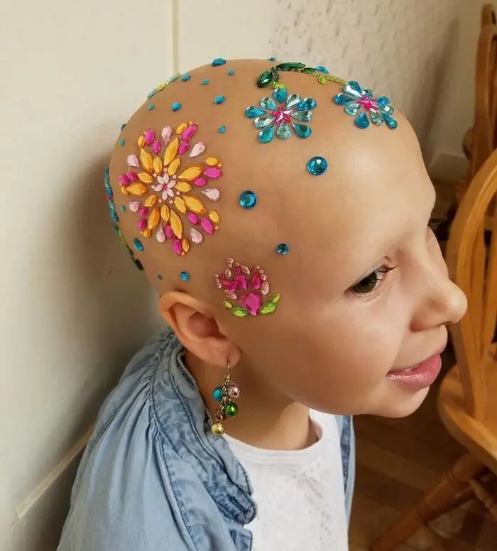 girl-alopecia-crazy-hair-day-gianessa-wride-13