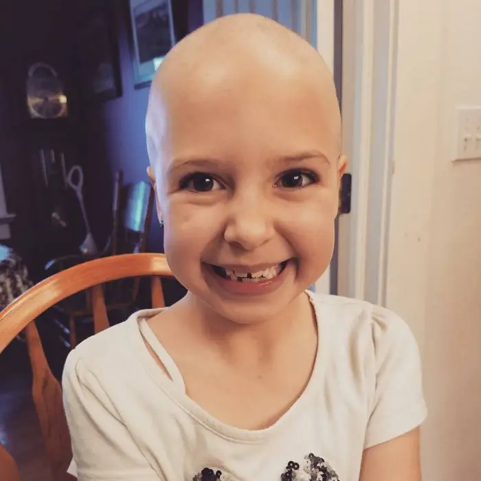 girl-alopecia-crazy-hair-day-gianessa-wride-9