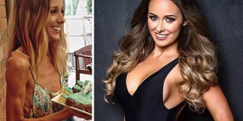 Anoreksiya İle Savaşlarından Zaferle Çıkmış 17 Kadının Yeni ve Sağlıklı Halleri