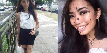 Malezya’nın Yeni Güzellik Kraliçesi Adayı, Tüm Vücudu Benlerle Kaplı Evita