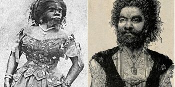 Yaşamı Boyunca İnsan Yerine Konmayan Julia Pastrana’nın Hüzünlü Hayat Hikayesi