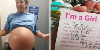 6 Kilo Dünyaya Gelerek 6 Aylık Gibi Görünen Tombiş Bebeğin Sevimli Fotoğrafları