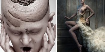 Alay Konusu Olduğu Genetik Rahatsızlığını Avantaja Çeviren Model Melanie