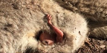 Hayata Tutunmak İçin Yardım Çağırısı Yapan Dünyanın En Minik ve Masum Eli