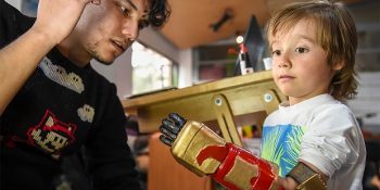 Engelli Çocuklara 3D Kollar Yapıp Onları Süper Kahramana Çeviren Harika Gençler