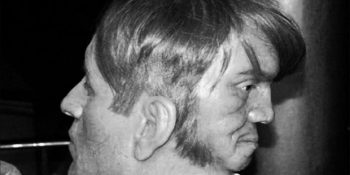 İki Yüzlü Olduğu İçin Dışlanan ve Sonunda İntihar Eden Edward Mordake’nin Acıklı Hikayesi